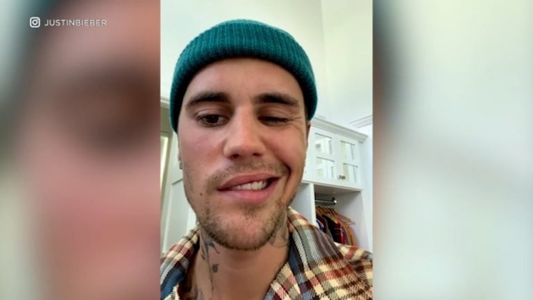 Justin Bieber suffers facial paralysis