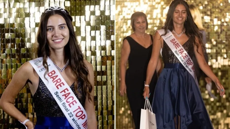 20-year-old-miss-england-finalist-becomes-first-contestant-to-go-makeup-free-in-pageant’s-history