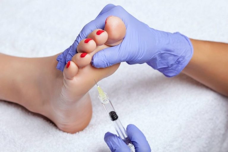 foot Botox