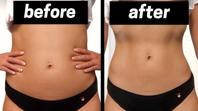 Weight loss
